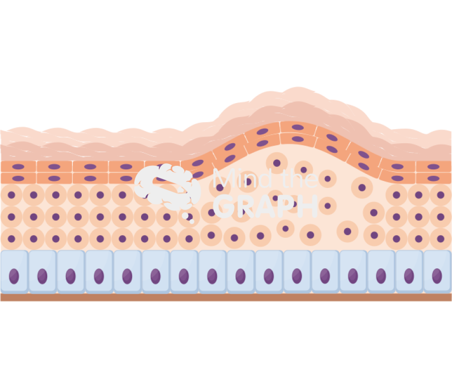 Intraepidermal blister skin Icons, Symbols, Pictures, and Images