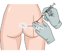 Intramuscular injection hand ventrogluteal back 1 - Edit and Customize Icons of Intramuscular injection hand ventrogluteal back 1 Intramuscular injection hand ventrogluteal back 1 Icons, Symbols, Pictures, and Images