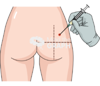 Intramuscular injection hand ventrogluteal back 2 - Edit and Customize Icons of Intramuscular injection hand ventrogluteal back 2 Intramuscular injection hand ventrogluteal back 2 Icons, Symbols, Pictures, and Images
