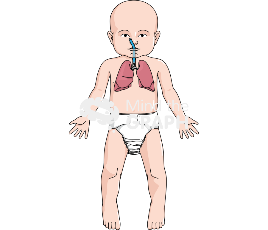 Intubated baby anatomic front Icons, Symbols, Pictures, and Images