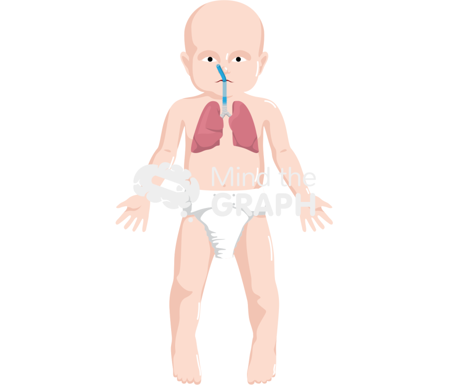Intubated baby anatomic front Icons, Symbols, Pictures, and Images