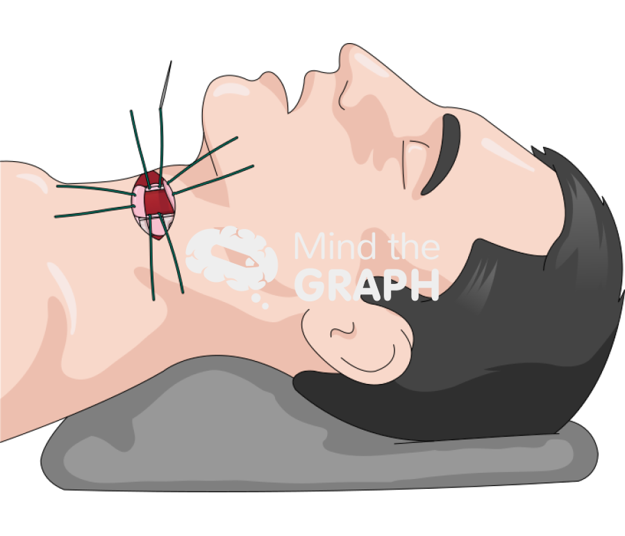 Inverted u incision tracheostomy suture Icons, Symbols, Pictures, and Images
