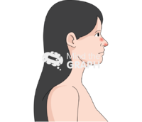 Kaposi sarcoma nose - Edit and Customize Icons of Kaposi sarcoma nose Kaposi sarcoma nose Icons, Symbols, Pictures, and Images
