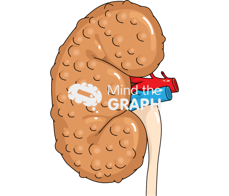 Kidney disease Icons, Symbols, Pictures, and Images