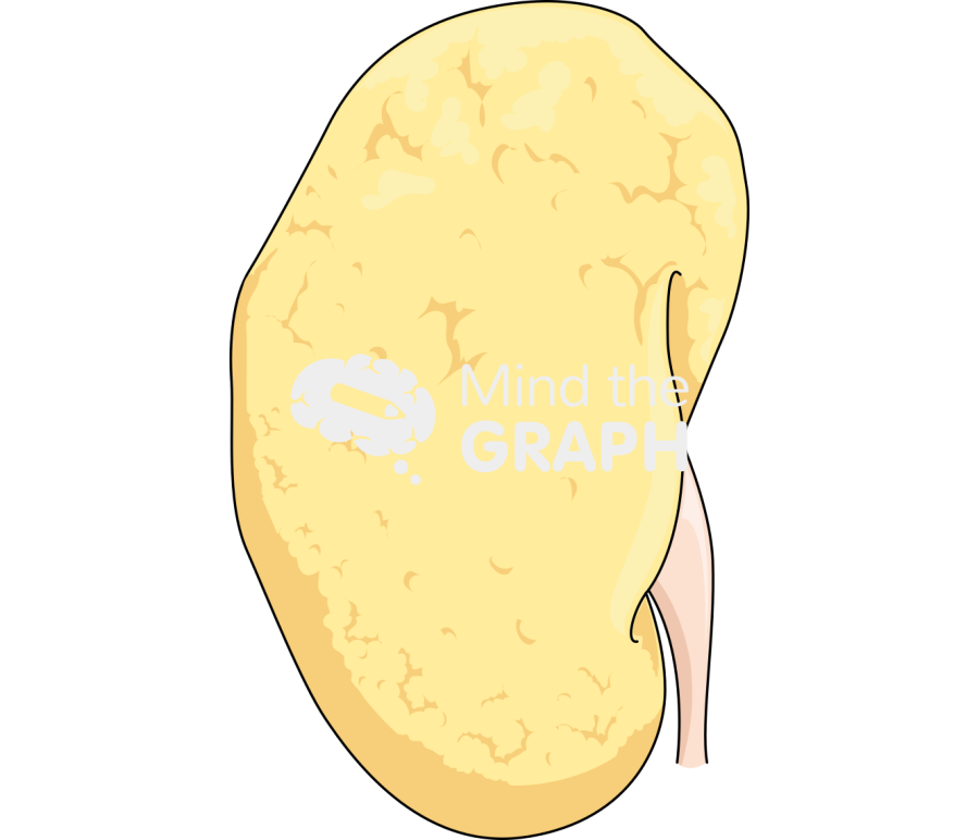 Kidney glomerulonephritis Icons, Symbols, Pictures, and Images