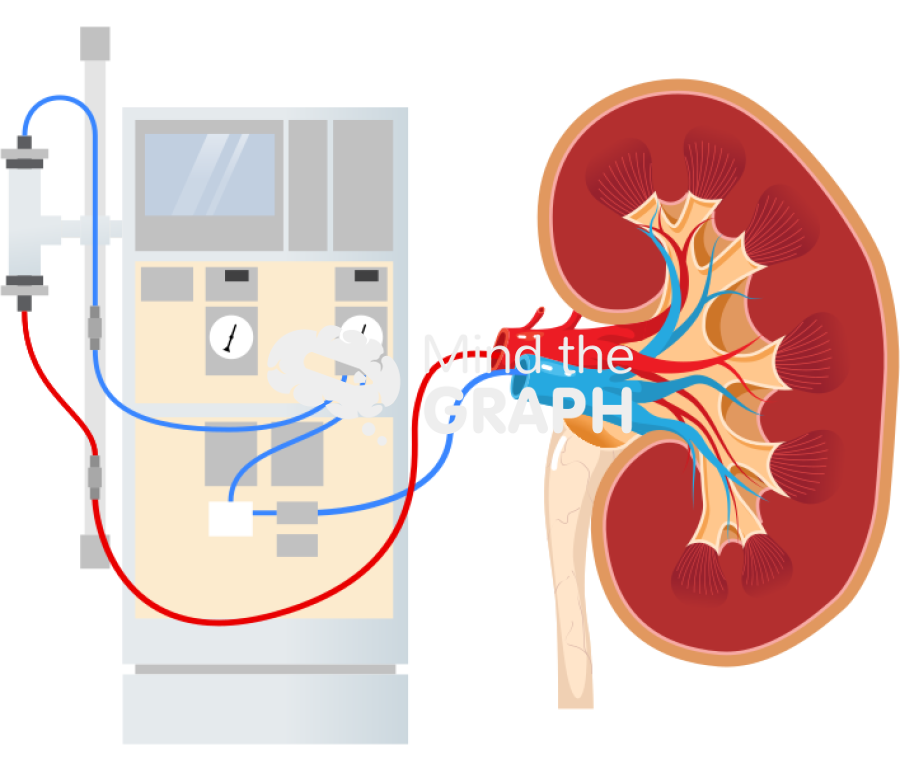Kidney hemodialysis Icons, Symbols, Pictures, and Images