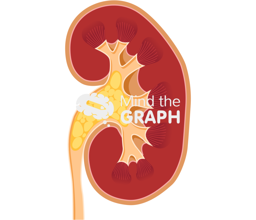 Kidney staghorn calculus Icons, Symbols, Pictures, and Images