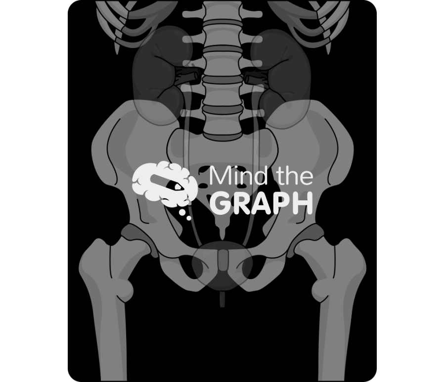 Kidney stone x ray Icons, Symbols, Pictures, and Images