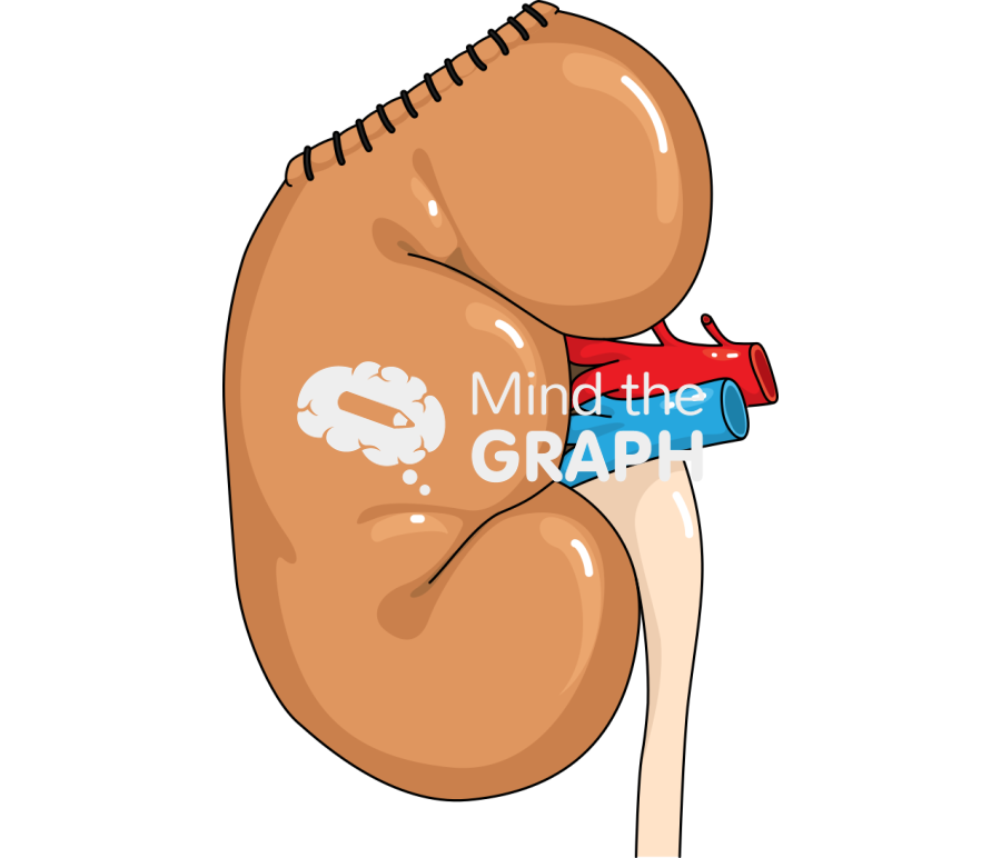 Kidney tumor nephrectormy 2 Icons, Symbols, Pictures, and Images