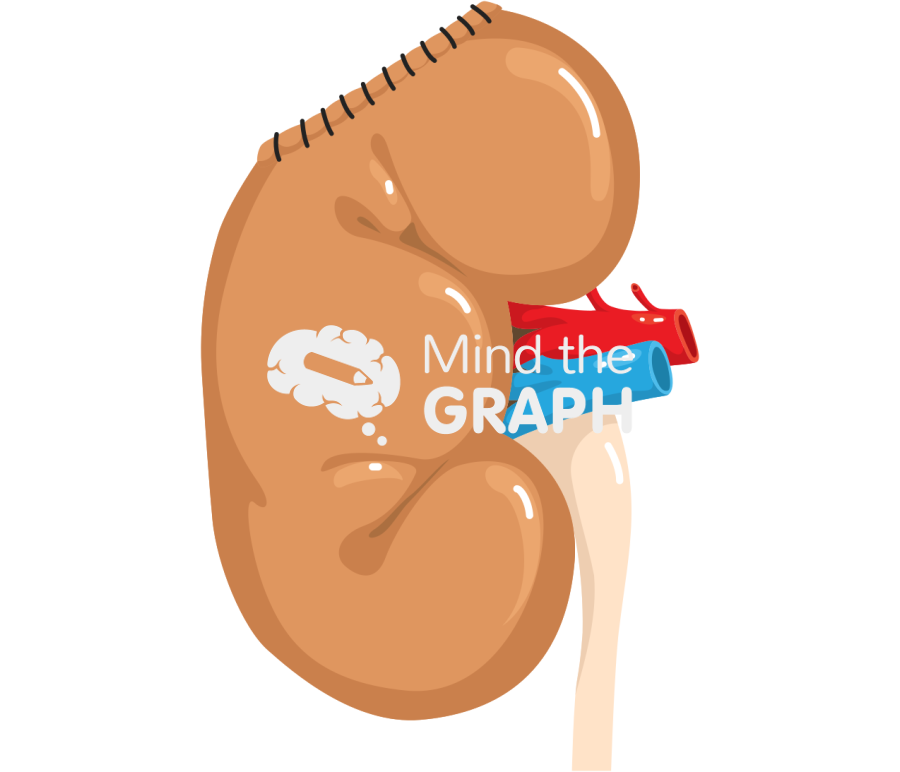 Kidney tumor nephrectormy 2 Icons, Symbols, Pictures, and Images