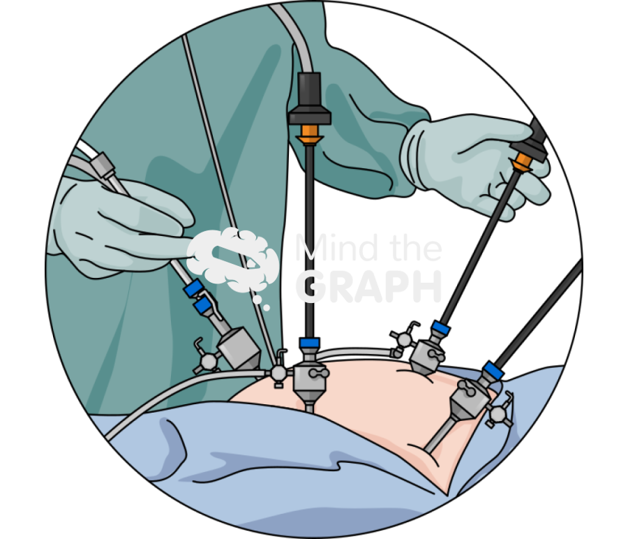 Laparoscopy diaphragm zoom Icons, Symbols, Pictures, and Images