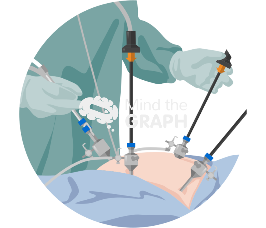 Laparoscopy diaphragm zoom Icons, Symbols, Pictures, and Images