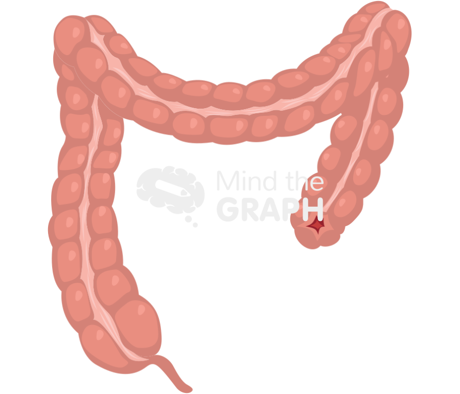 Large intestine abdominal perineal resection front Icons, Symbols, Pictures, and Images