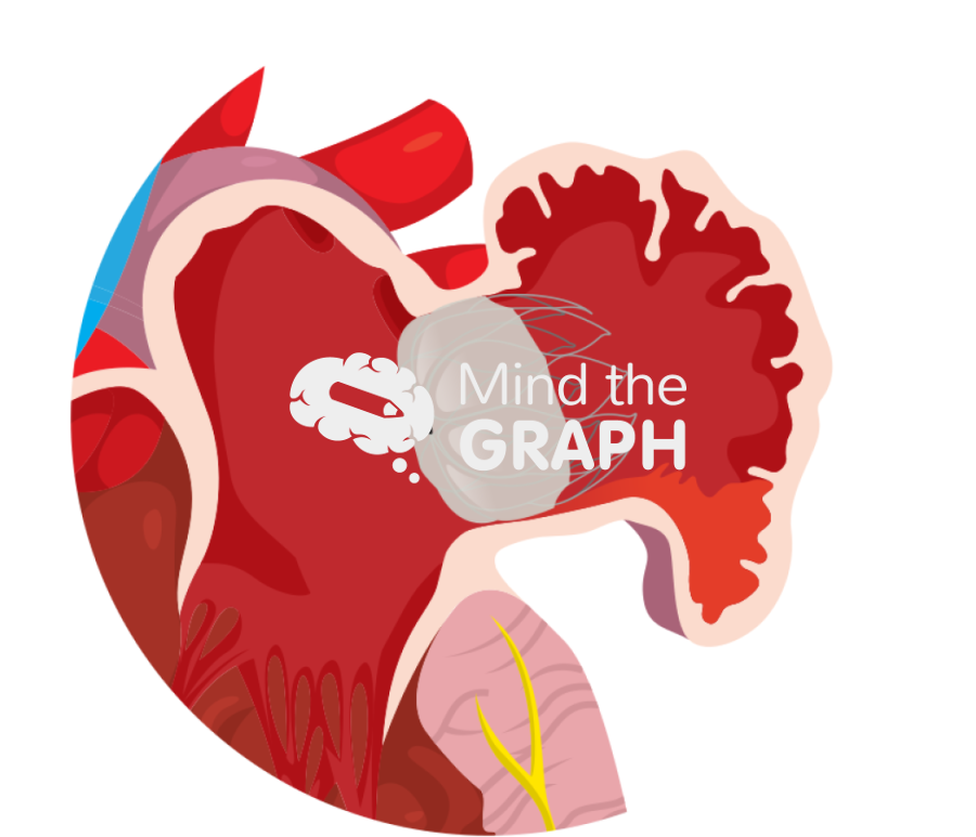 Left atrial appendage pdl edge leak zoom Icons, Symbols, Pictures, and Images