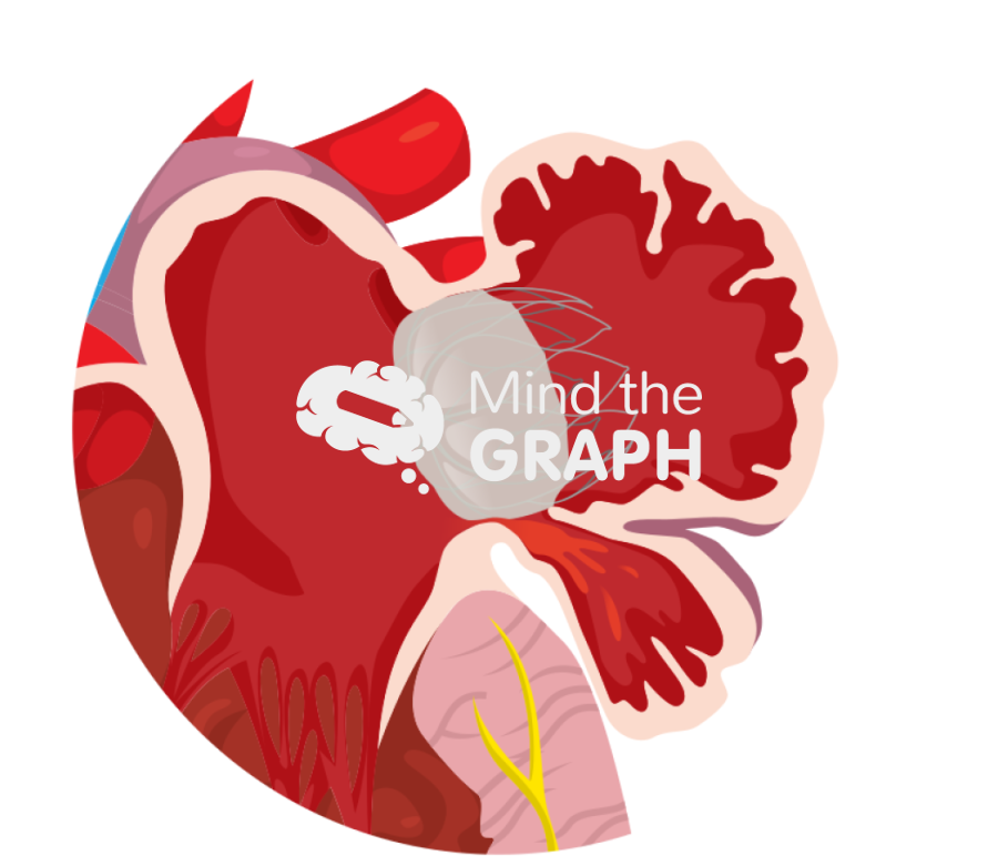 Left atrial appendage pdl uncovered lobe zoom Icons, Symbols, Pictures, and Images