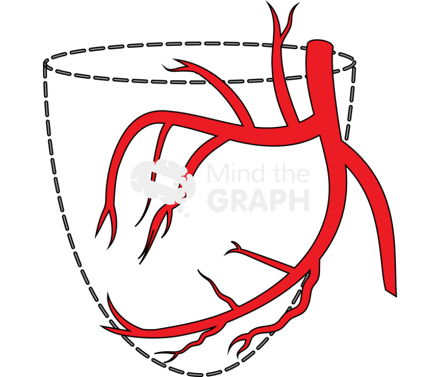 Left coronary artery in rao view Icons, Symbols, Pictures, and Images
