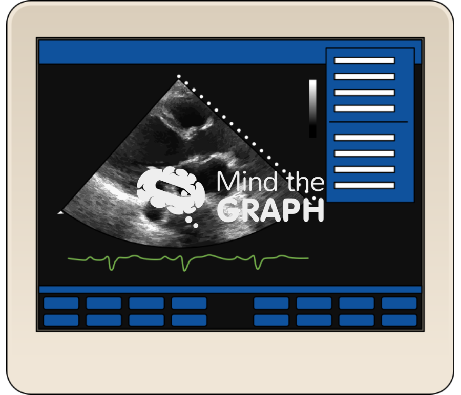 Left ventricular ejection fraction lvef equipment Icons, Symbols, Pictures, and Images