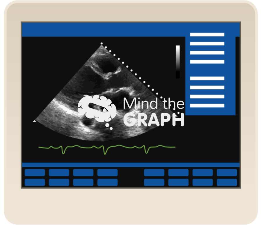 Left ventricular ejection fraction lvef equipment Icons, Symbols, Pictures, and Images