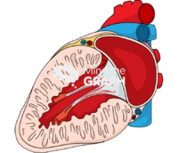 Left ventricular remodeling following myocardial infarction 1 Icons, Symbols, Pictures, and Images