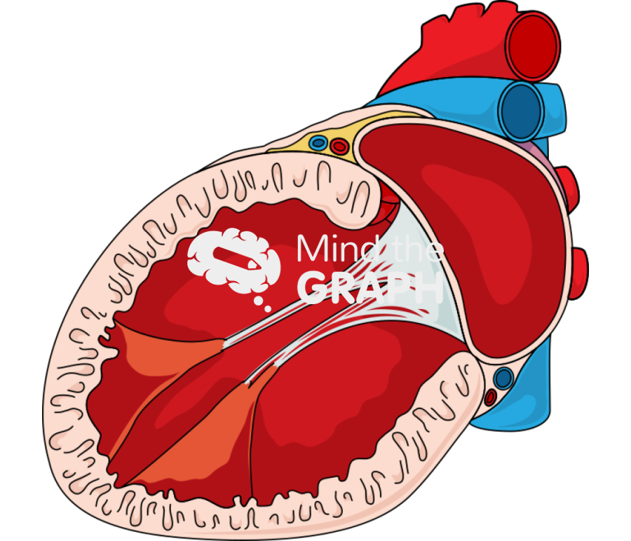 Left ventricular remodeling following myocardial infarction 2 Icons, Symbols, Pictures, and Images