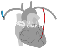 Light internal mammary artery contralateral arteriovenous fistula 2 - Edit and Customize Icons of Light internal mammary artery contralateral arteriovenous fistula 2 Light internal mammary artery contralateral arteriovenous fistula 2 Icons, Symbols, Pictures, and Images