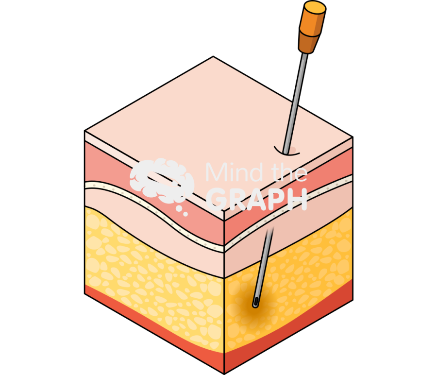 Liposuction perspective Icons, Symbols, Pictures, and Images