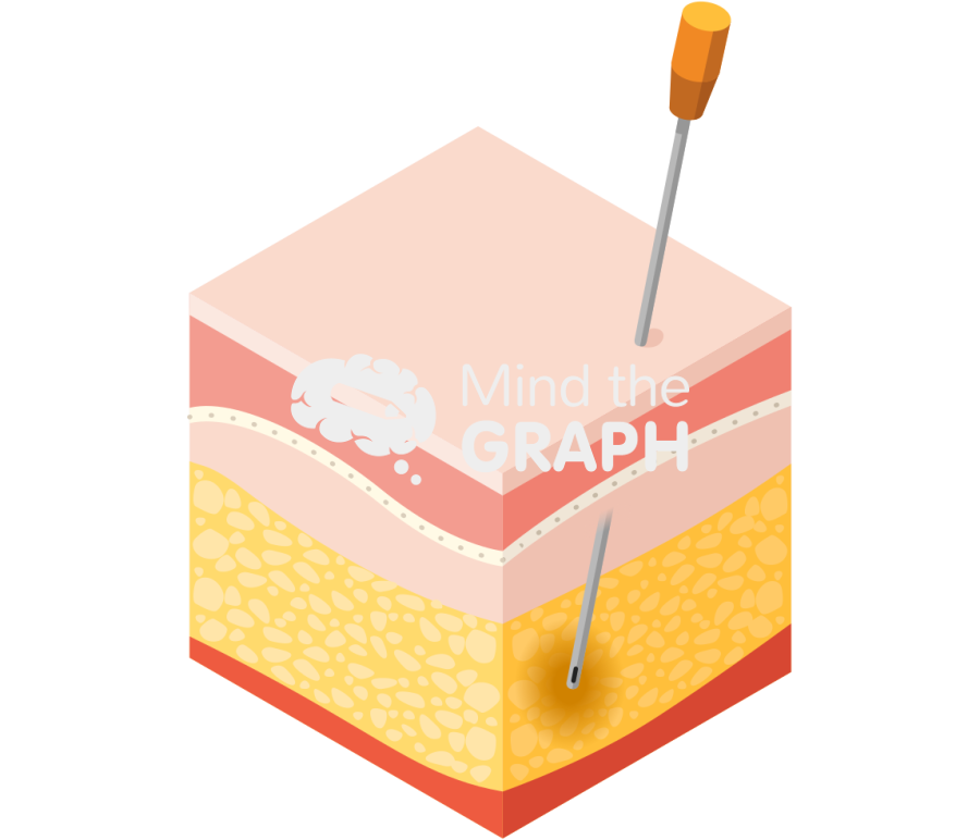 Liposuction perspective