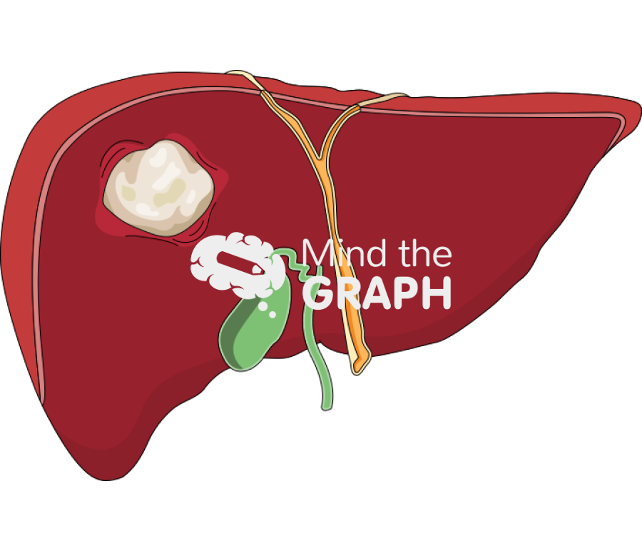 Liver abscess Icons, Symbols, Pictures, and Images
