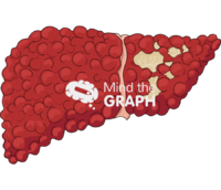 Liver cirrhosis carcinoma side 2 Icons, Symbols, Pictures, and Images