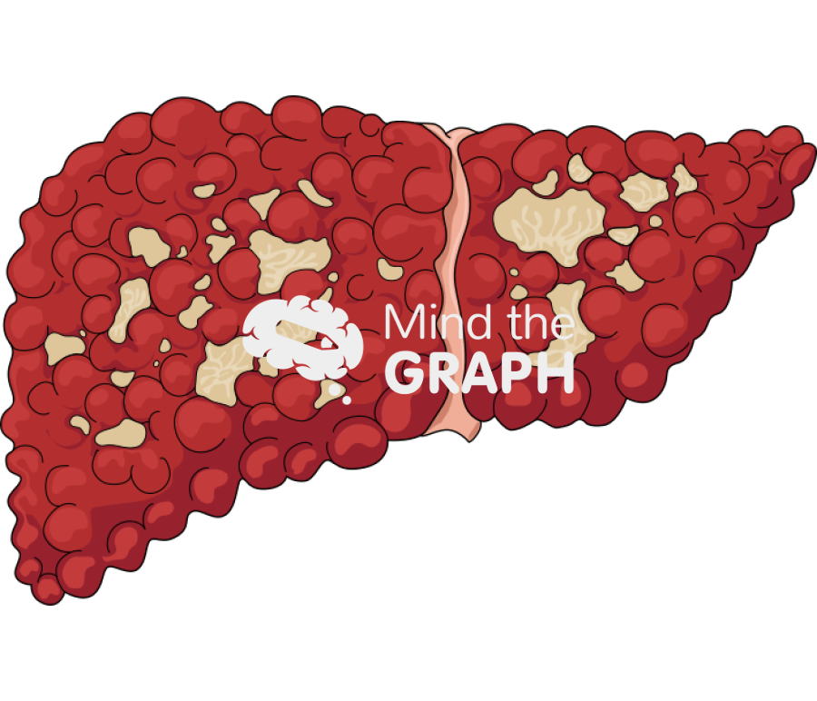 Liver cirrhosis carcinoma side 3 Icons, Symbols, Pictures, and Images