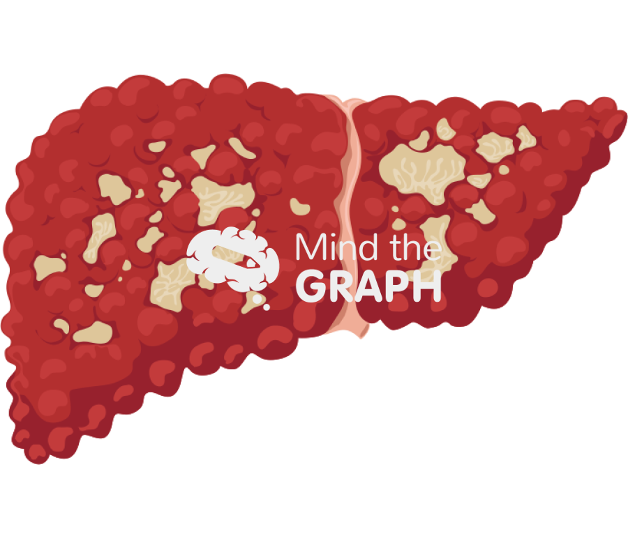 Liver cirrhosis carcinoma side 3 Icons, Symbols, Pictures, and Images