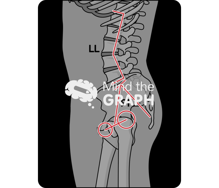 Lumbar lordosis pelvic incidence x ray Icons, Symbols, Pictures, and Images