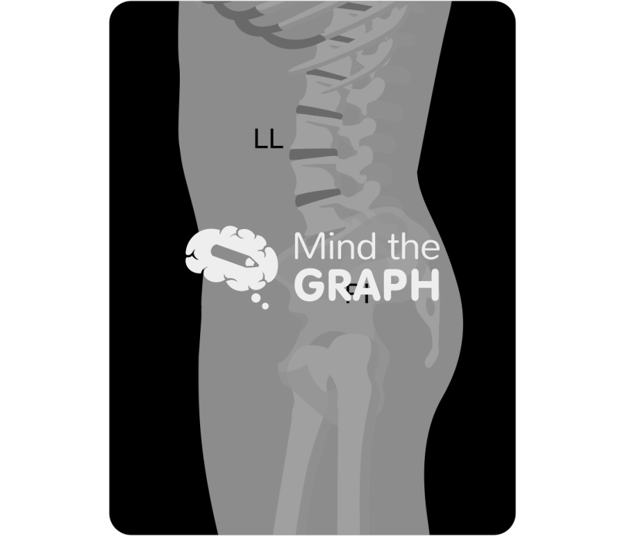 Lumbar lordosis pelvic incidence x ray Icons, Symbols, Pictures, and Images
