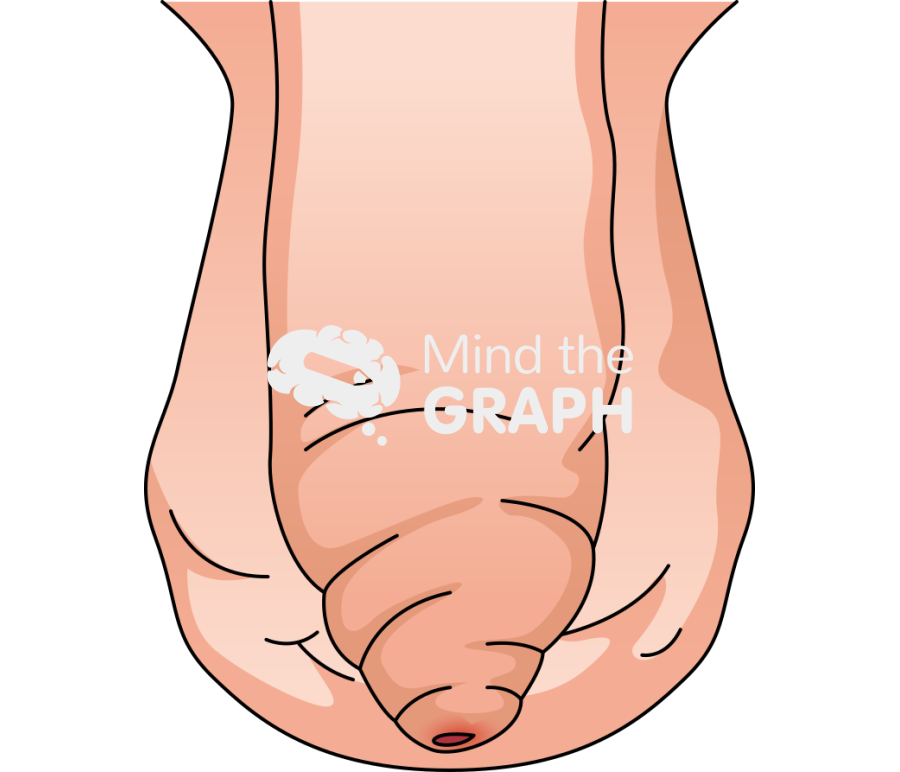 Male genitalia phimosis Icons, Symbols, Pictures, and Images