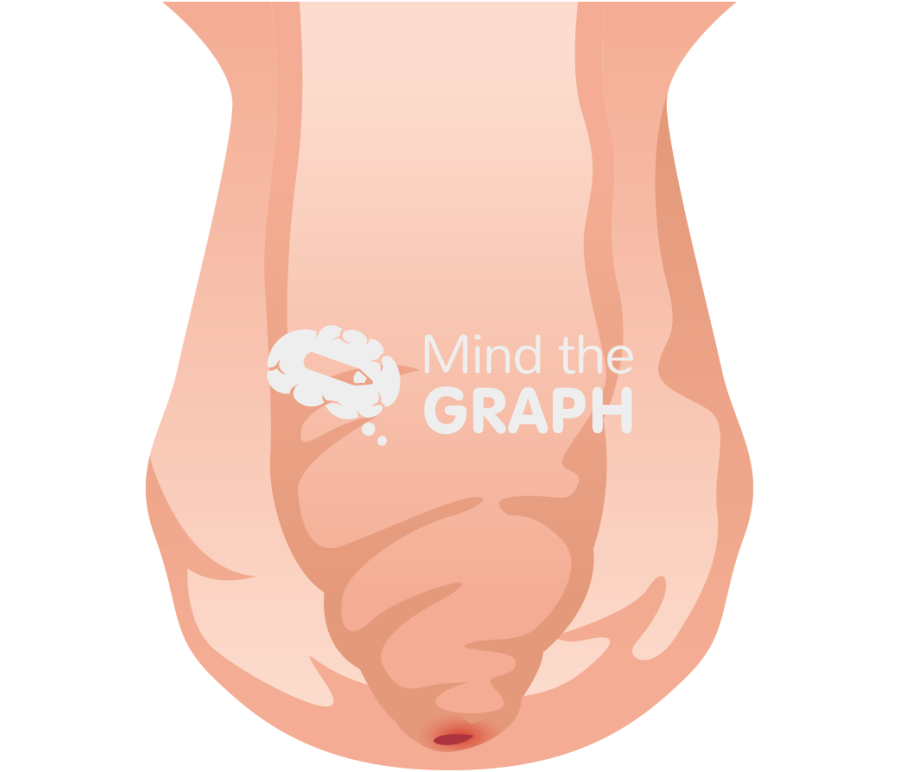 Male genitalia phimosis Icons, Symbols, Pictures, and Images