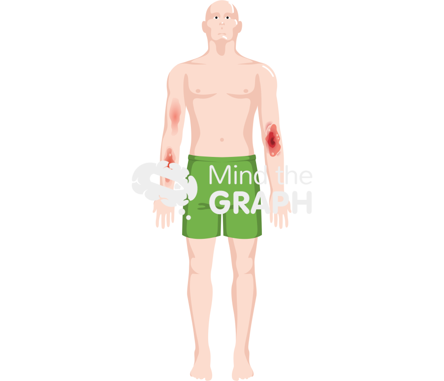 Man burn wound Icons, Symbols, Pictures, and Images