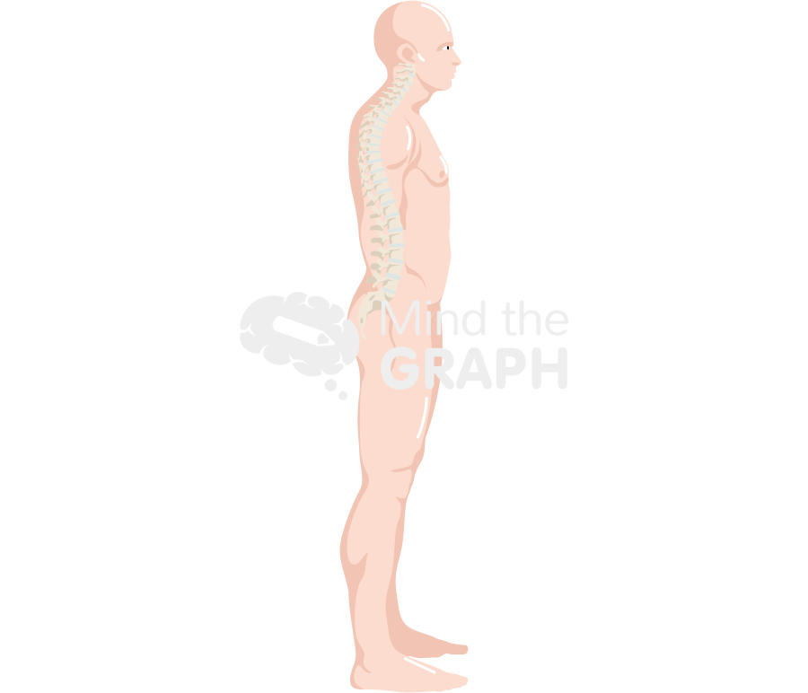 Free Man column kyphosis lateral body full Icons, Symbols, Pictures ...