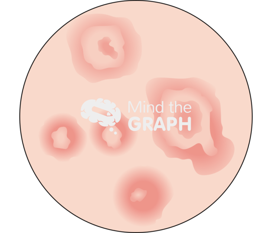 Man erythema multiforme zoom Icons, Symbols, Pictures, and Images