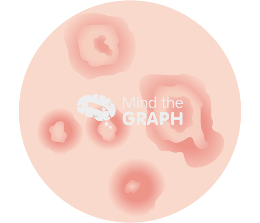 Man erythema multiforme zoom Icons, Symbols, Pictures, and Images