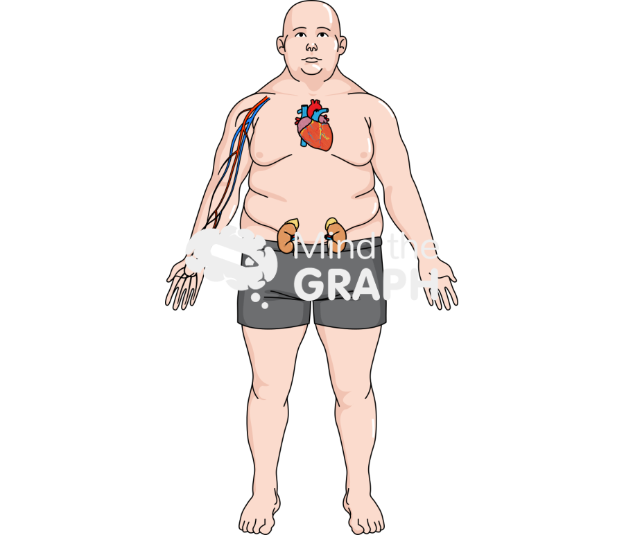 Man obese heart kidney artery front Icons, Symbols, Pictures, and Images