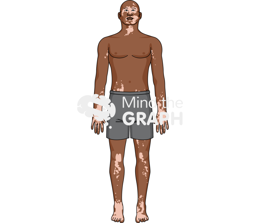 Man vitiligo shorts afro Icons, Symbols, Pictures, and Images