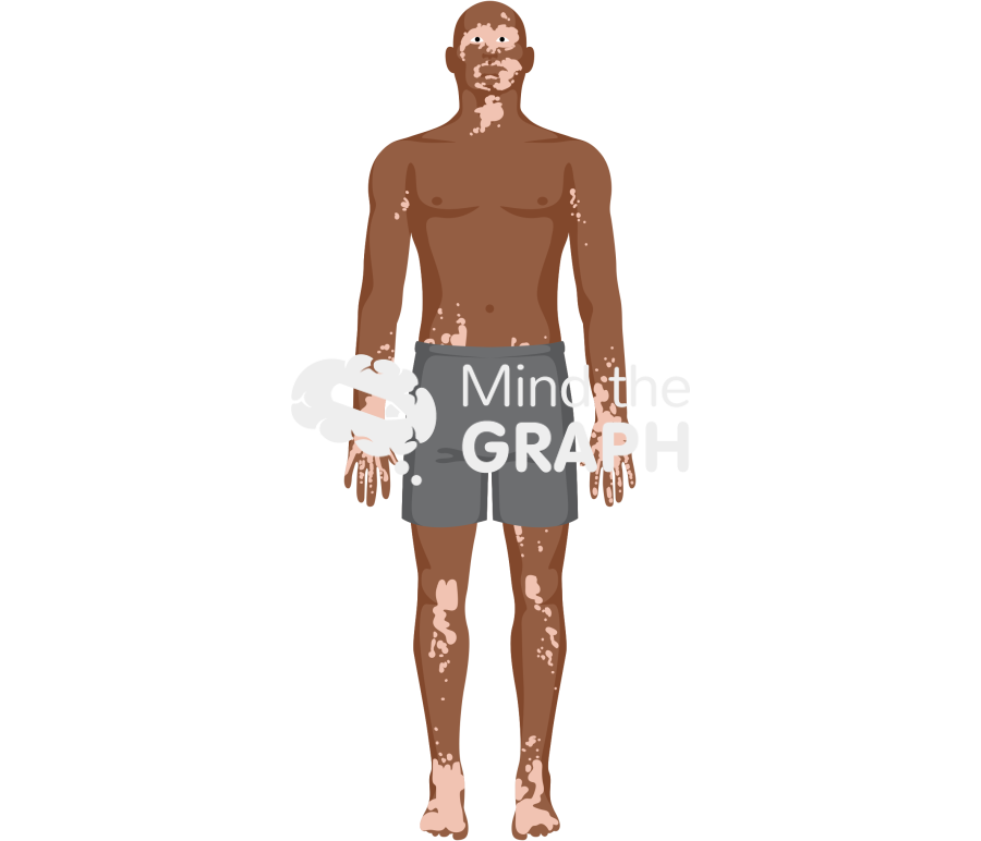 Man vitiligo shorts afro Icons, Symbols, Pictures, and Images