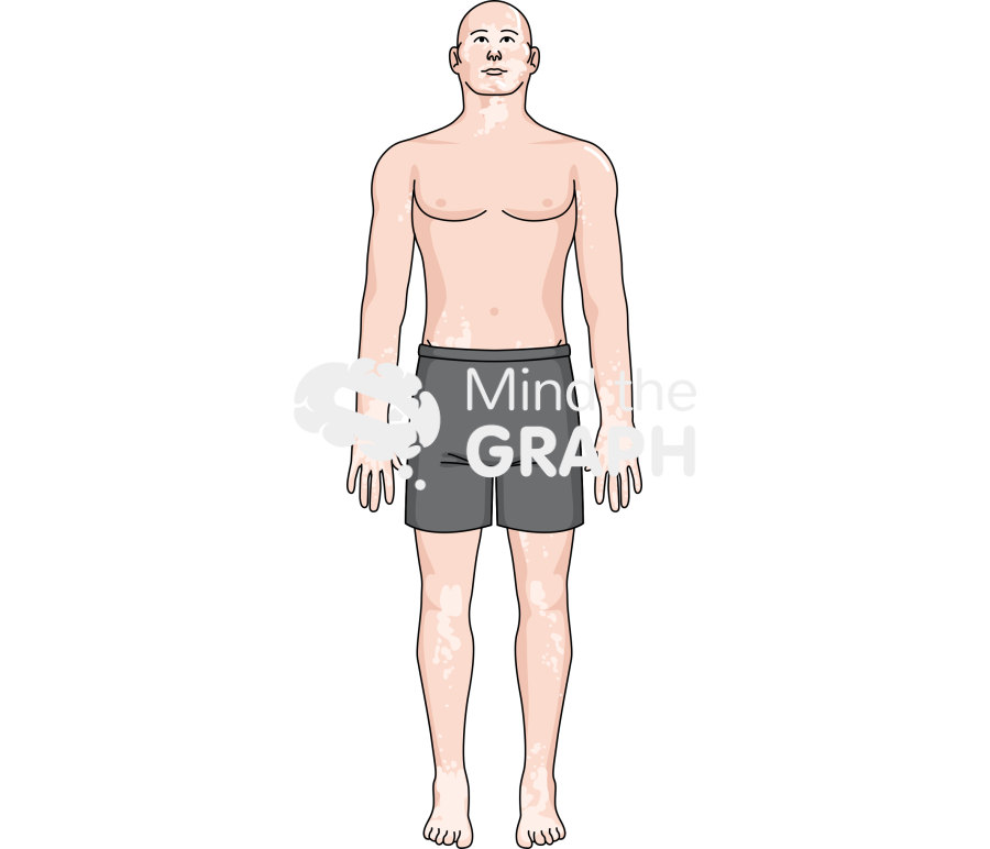 Man vitiligo shorts caucasian Icons, Symbols, Pictures, and Images