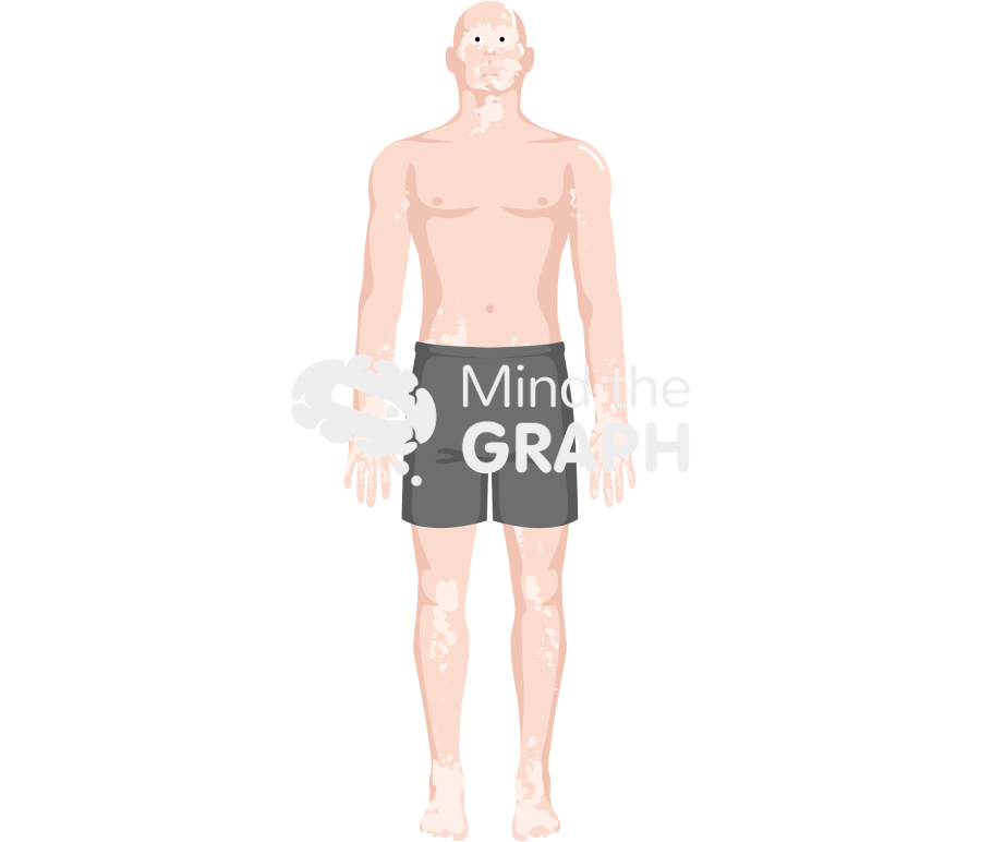 Man vitiligo shorts caucasian Icons, Symbols, Pictures, and Images