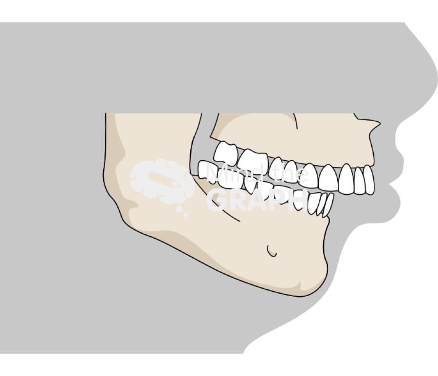 Mandibular deficiency and orthognathic surgery 1 Icons, Symbols, Pictures, and Images