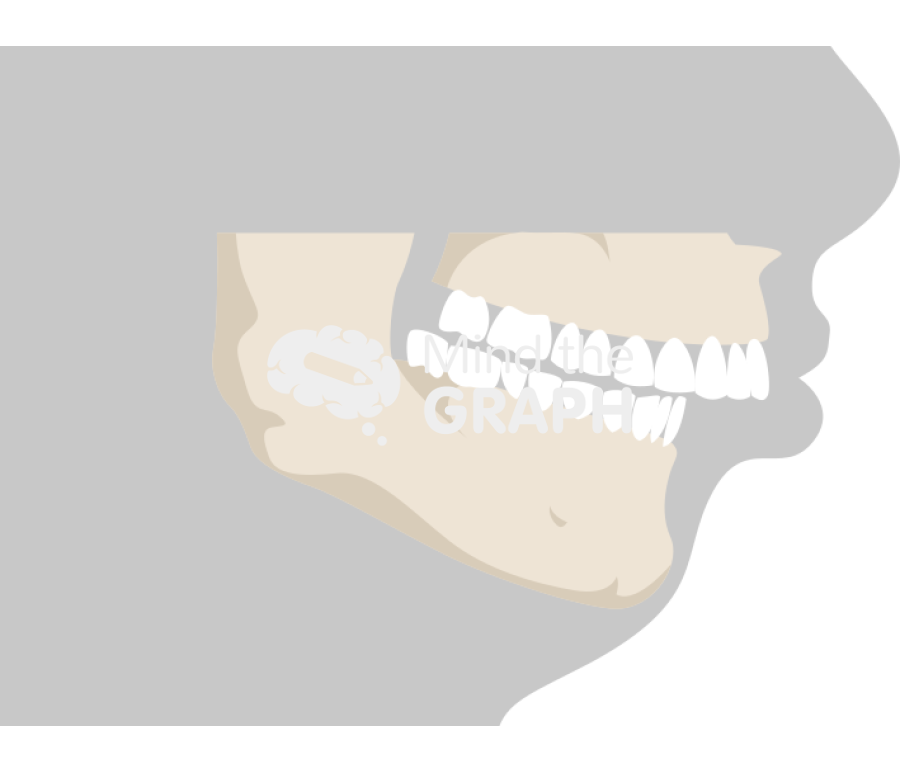 Mandibular deficiency and orthognathic surgery 1 Icons, Symbols, Pictures, and Images