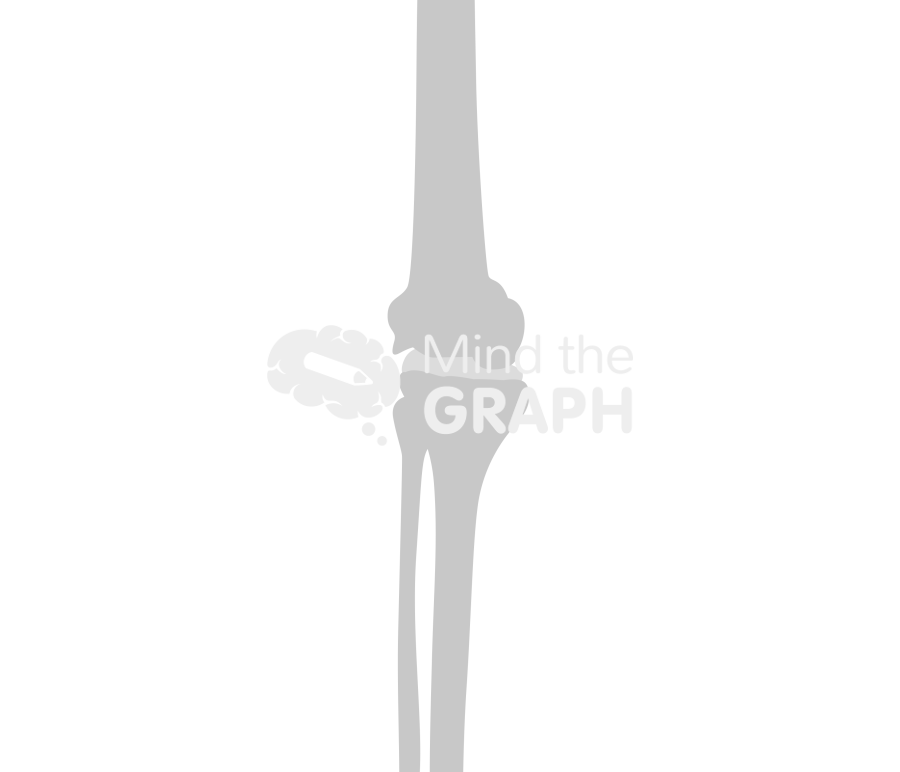 Medial tibiofemoral subluxation bone Icons, Symbols, Pictures, and Images