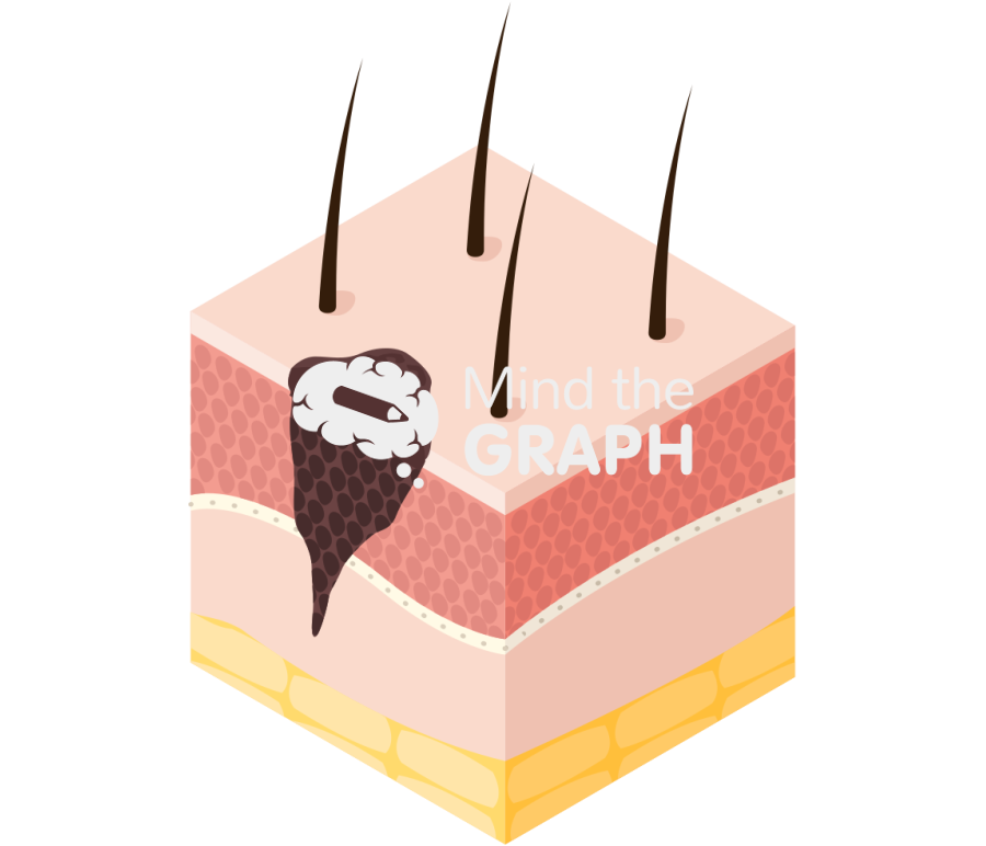 Melanoma skin perspective Icons, Symbols, Pictures, and Images