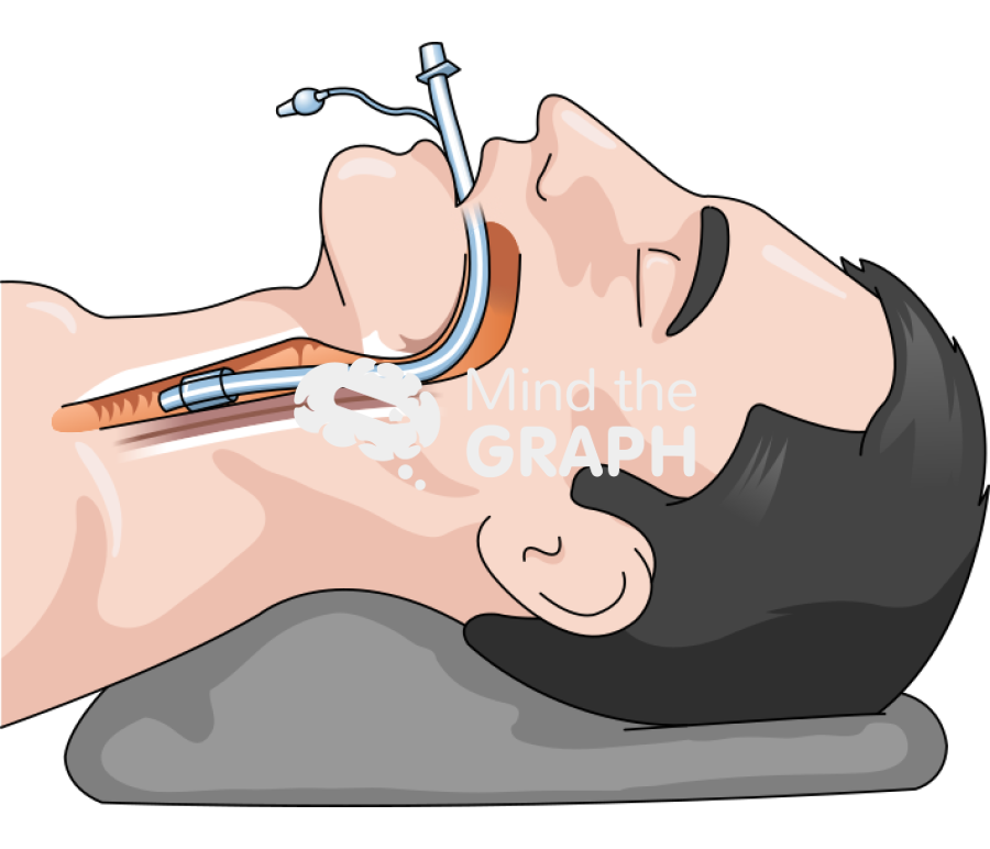 Men intubation detailed Icons, Symbols, Pictures, and Images