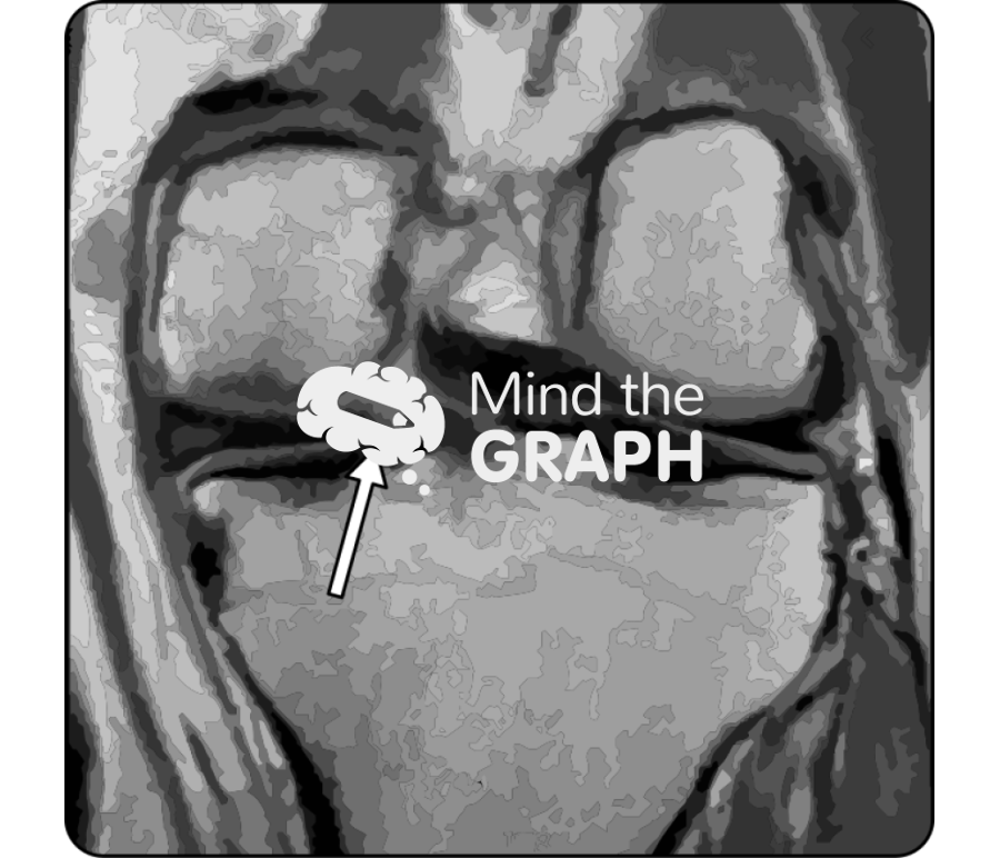 Meniscus root tear mri Icons, Symbols, Pictures, and Images